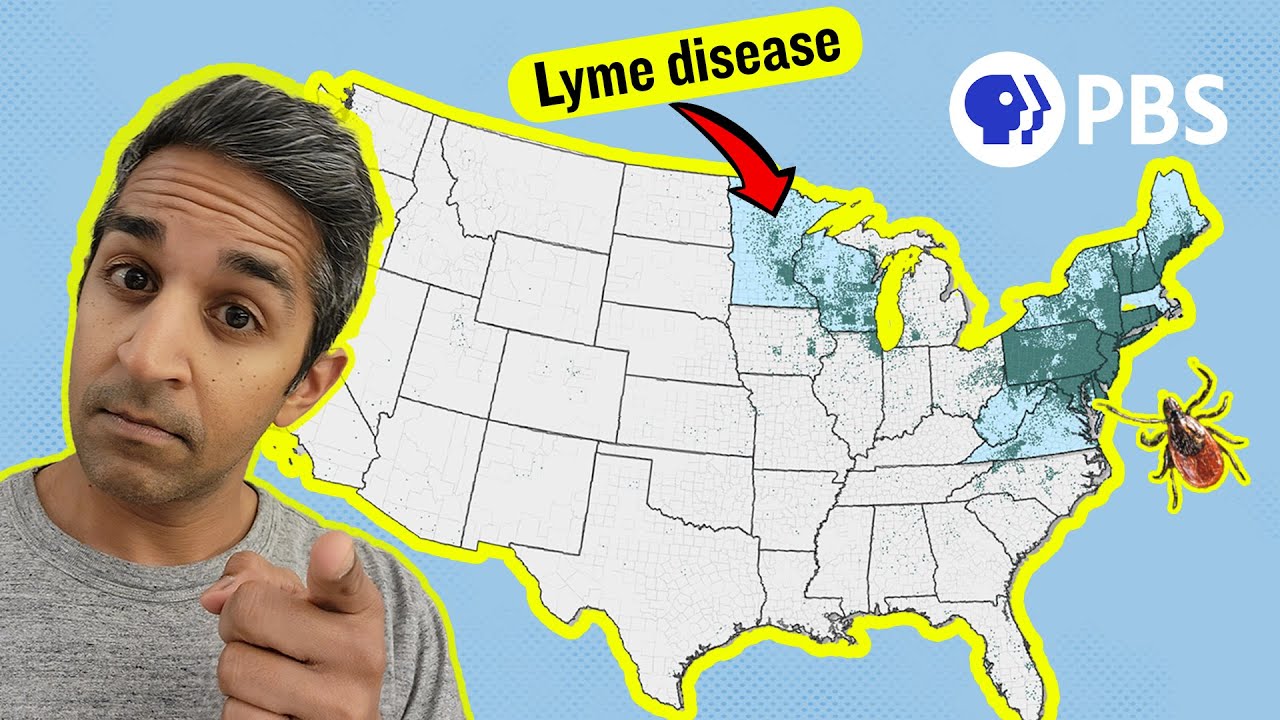 Lyme Disease Cases Are Surging. Who Is Most At Risk?