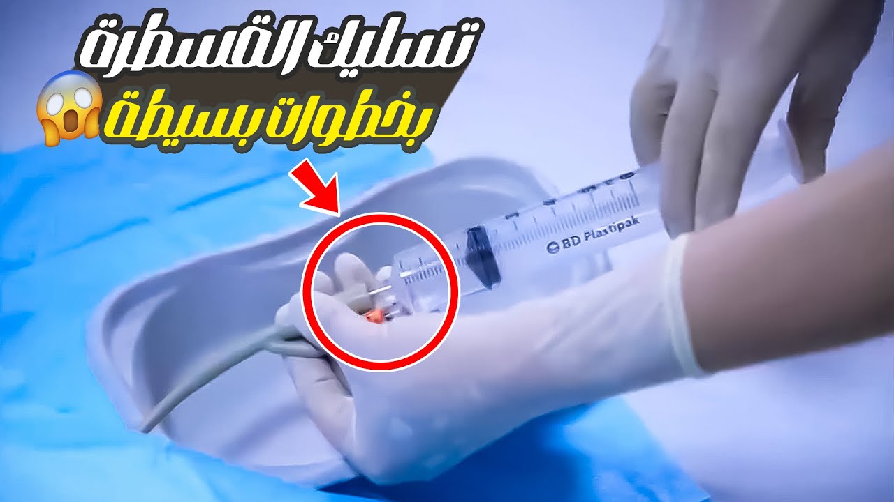 مهارات التمريض | (15) إزاي تسلك القسطرة البولية بأمان؟  – How to flush a urinary catheter