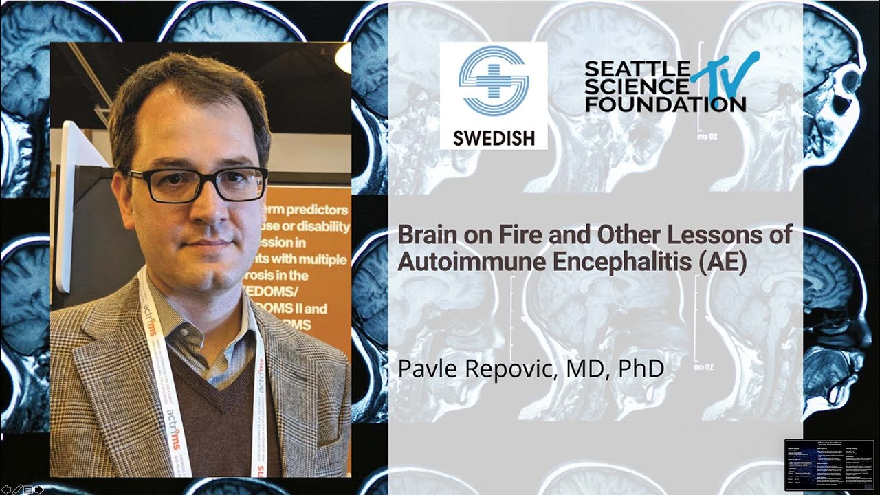 Brain on Fire & Other Lessons  of Autoimmune Encephalitis - Pavel Repovic, MD