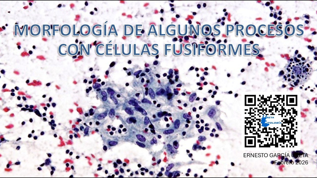MORFOLOGÍAS DE ALGUNOS PROCESOS CON CÉLULAS FUSIFORMES 2026