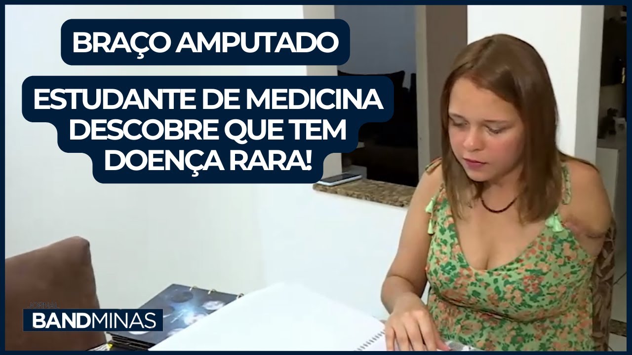 ESTUDANTE DE MEDICINA TEM BRAÇO AMPUTADO DEPOIS DE DESCOBRIR DOENÇA! | JORNAL BAND MINAS 08/09/2023