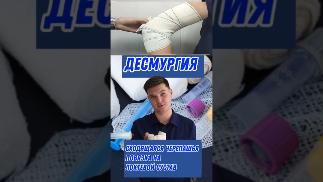 Сходящаяся черепашья повязка на локтевой сустав. Техника выполнения.#десмургия#травма#orthopro