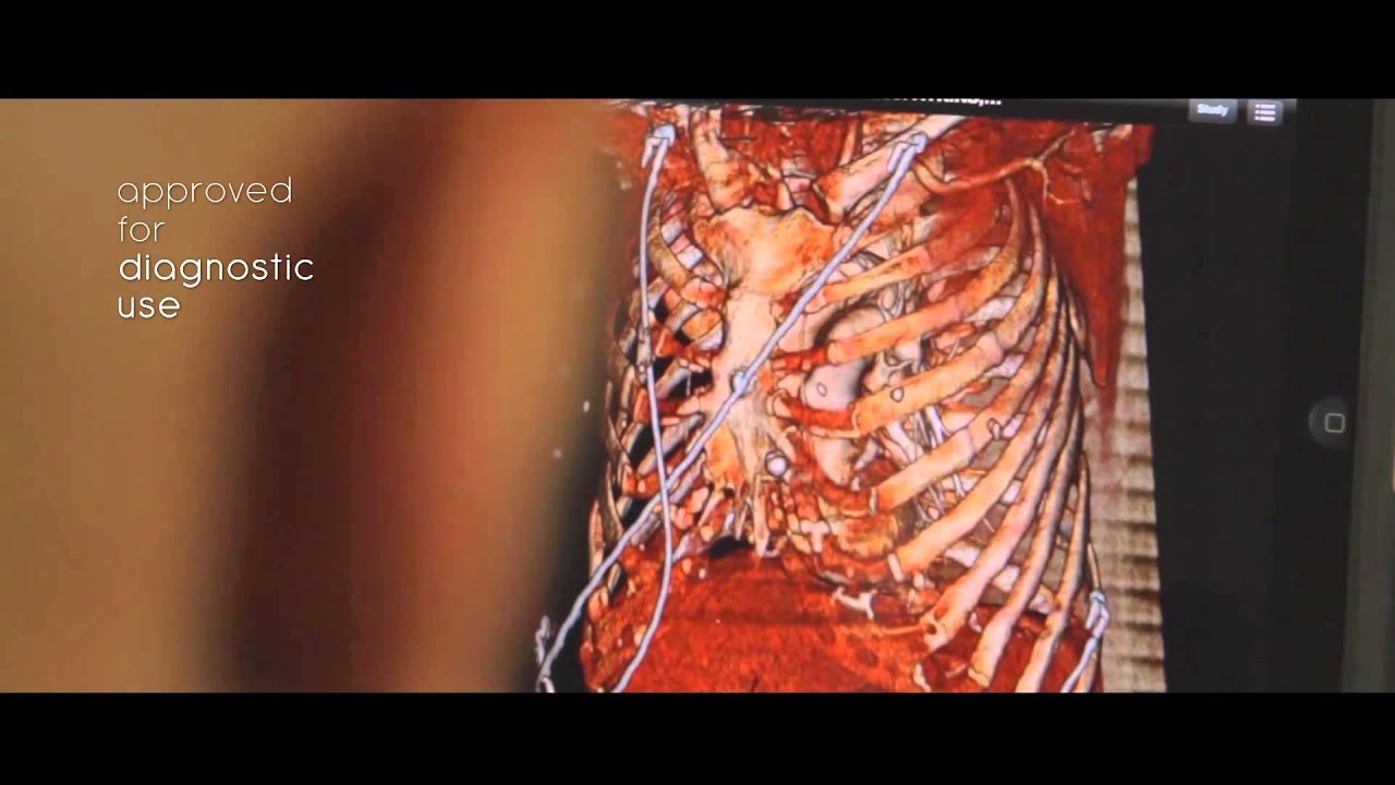 SYNAPSE Clinical Workflow Manager   FUJIFILM HD