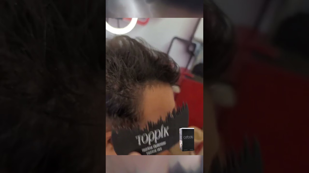 Thin Hair NO MORE! Toppik Hairline Optimizer Transformation Before & After!  #hairbuildingfibres