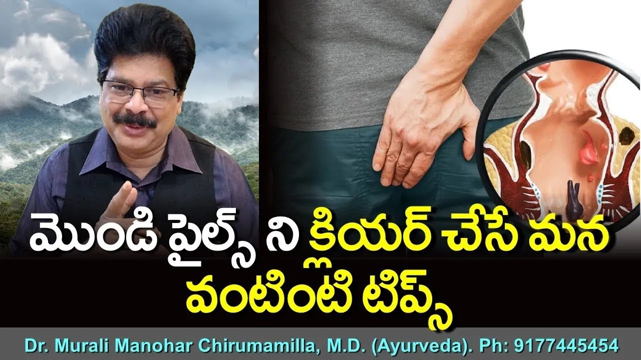 ఎవరికీ చెప్పుకోలేని పైల్స్ సమస్యను పిప్పి పిప్పి చేసే ఇంటి వైద్యం! home remedy that will cure piles!