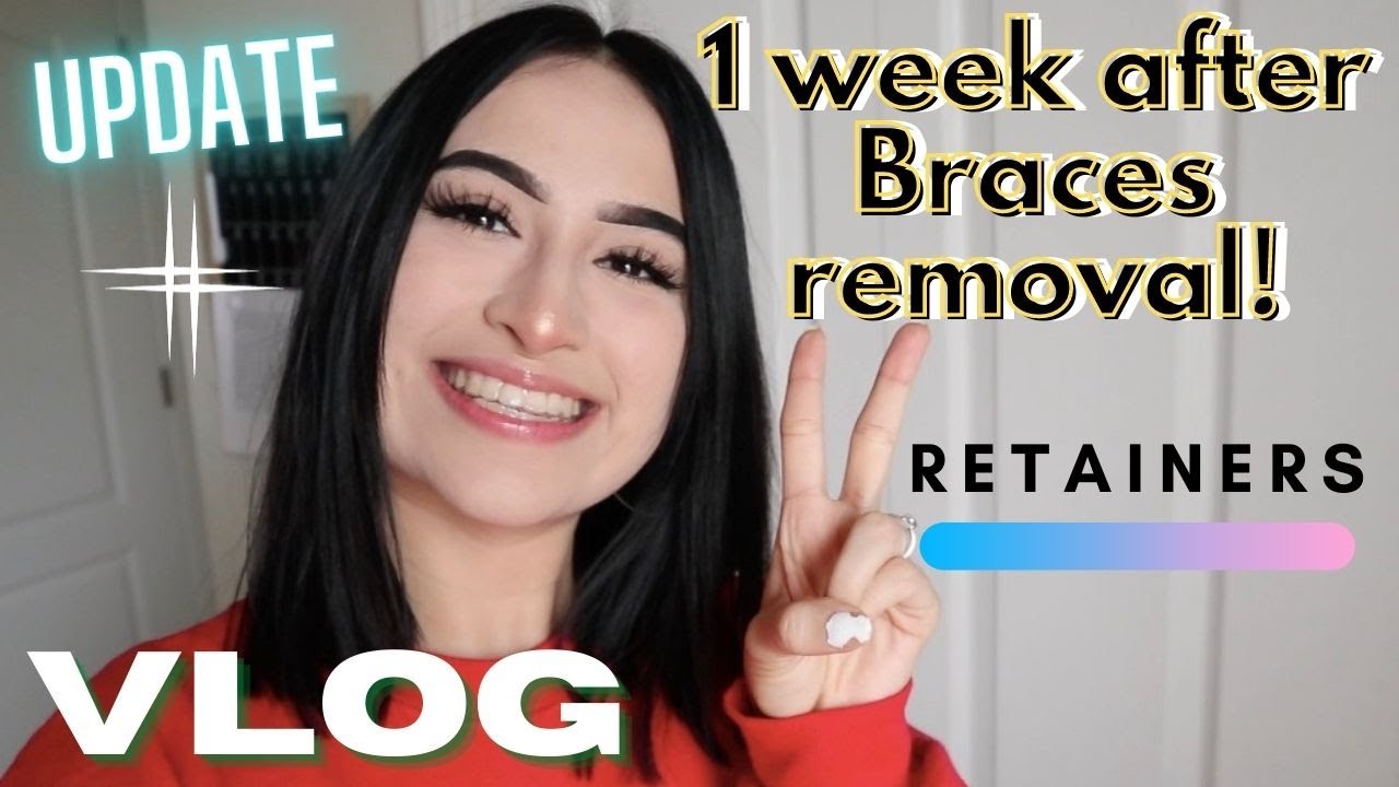 VLOG // 1 week after BRACES REMOVAL *update*