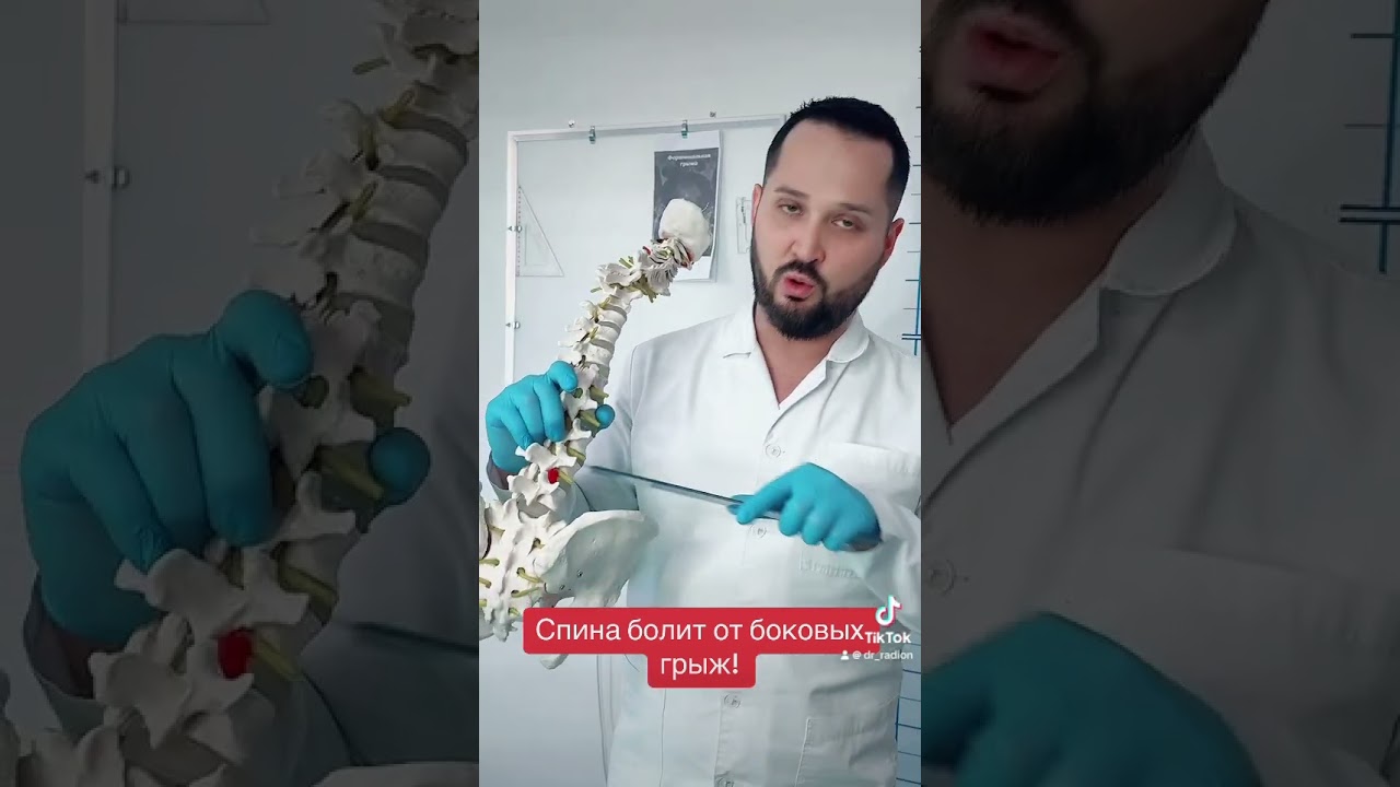 Фораминальная грыжа диска
