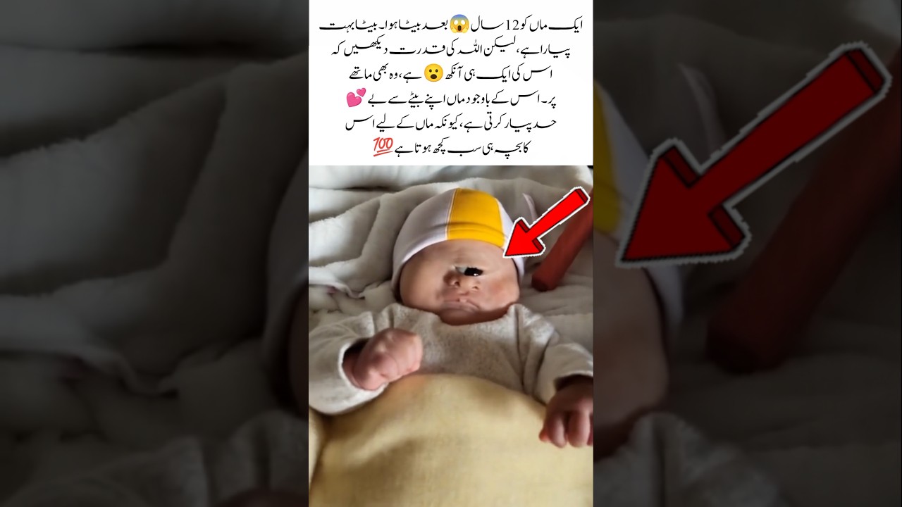 Mother Gets Baby After 12 Years, But One Eye! #shorts #youtubeshorts #supergrandma #proudparents