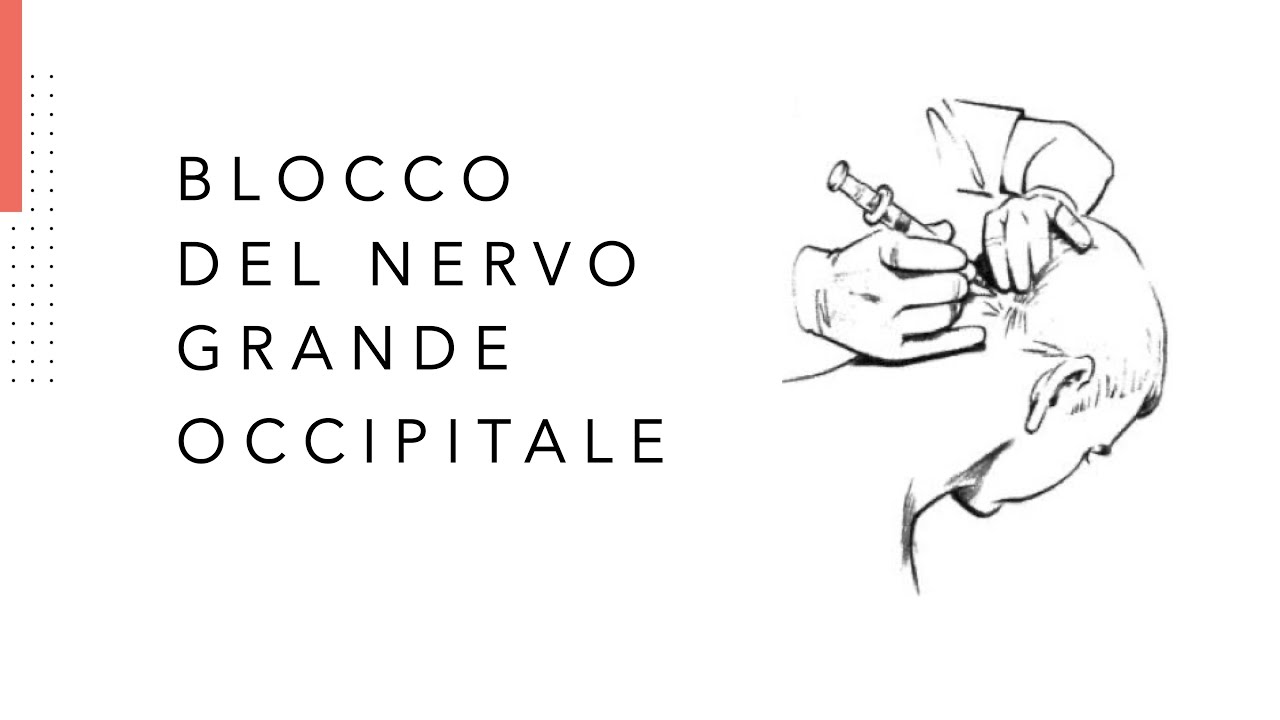 Blocco del Nervo Grande Occipitale: è utile per i mal di testa? E in quali forme? Vi spiegherò tutto