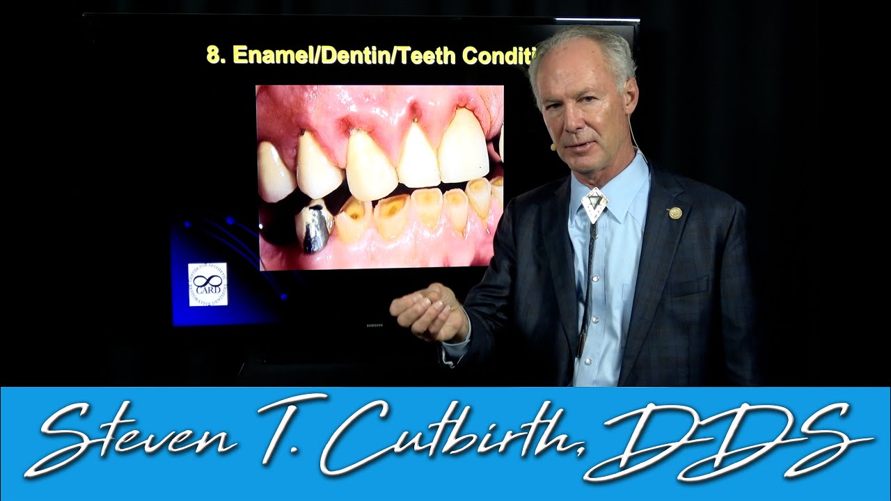 Treatment Planning Complex Cases (Part 4 of 4) - Dental Minute with Steven T. Cutbirth, DDS