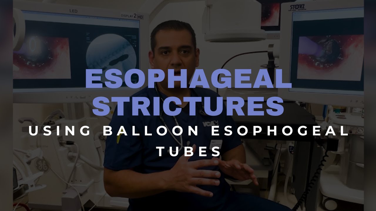 New standard of care for treating esophageal strictures in pets