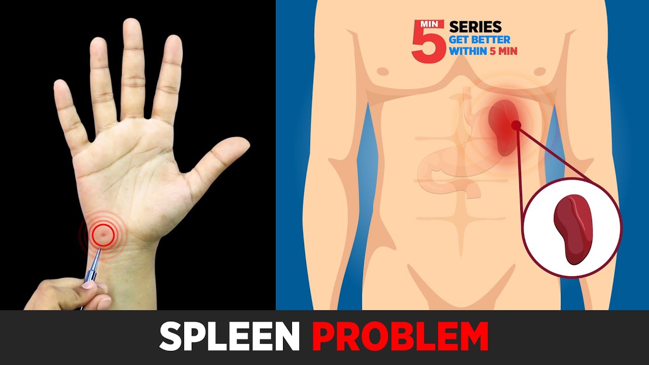 SUJOK TREATMENT FOR SPLEEN DISORDER🔥