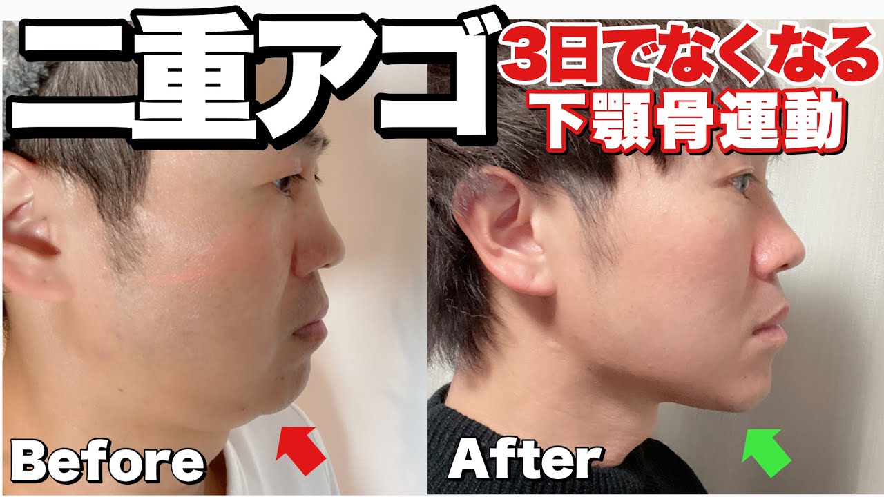二重アゴ！3日でなくした下顎骨運動とマッサージ方法！