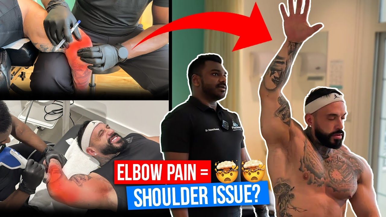 IFBB Pro’s Elbow Pain Wasn’t What He Thought—Here’s the Real Problem!😱🤯