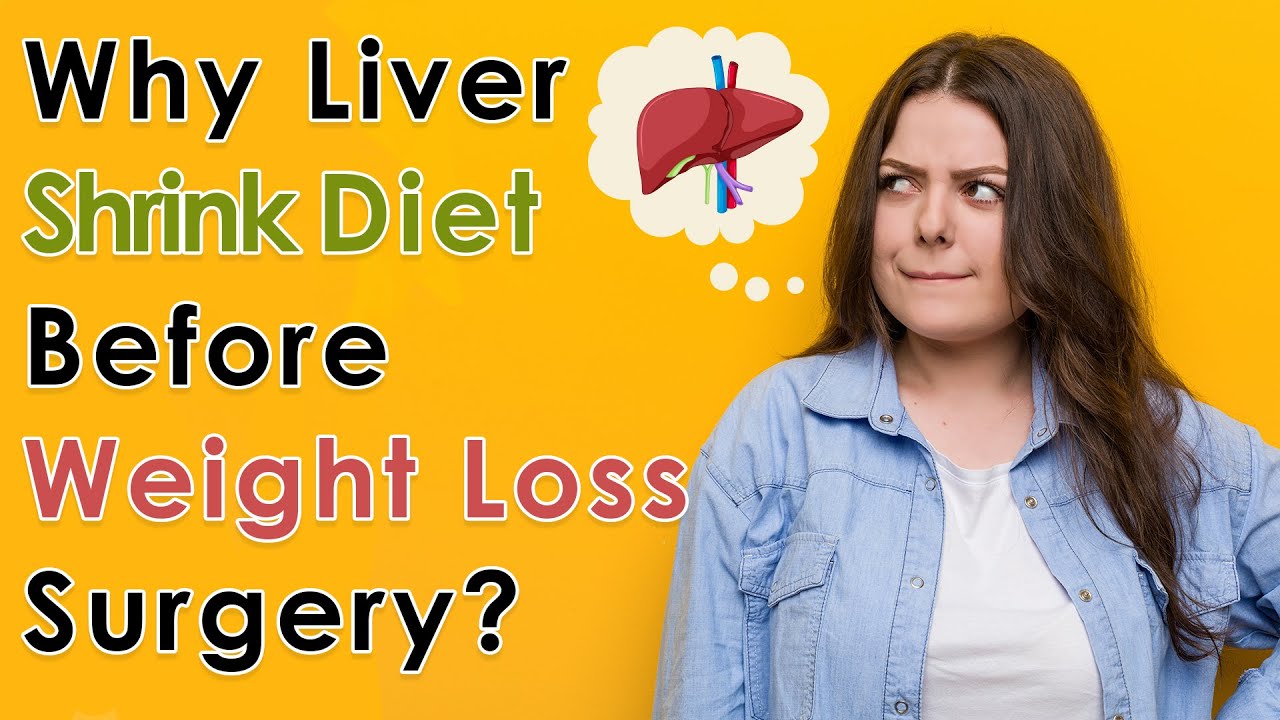Explained: Liver Shrink Diet (Pre-Op) | Mexico Bariatric Services