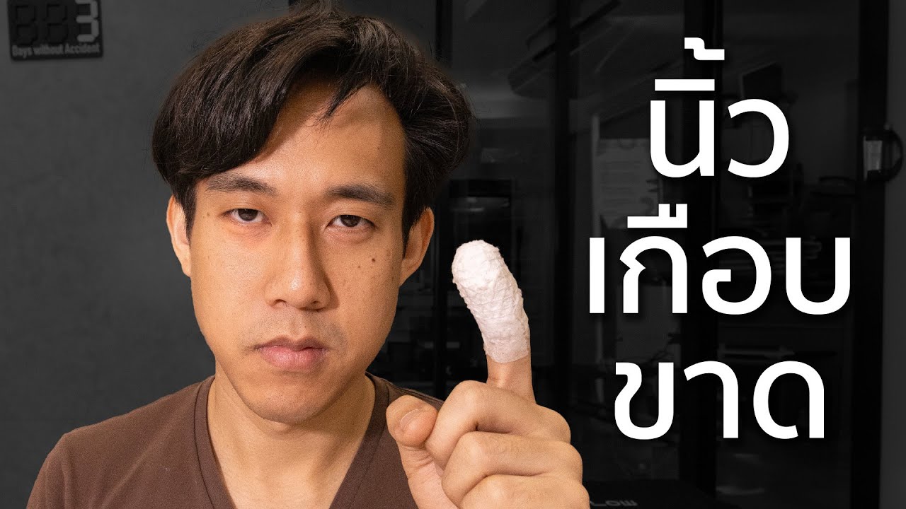 นิ้วเกือบขาด!?