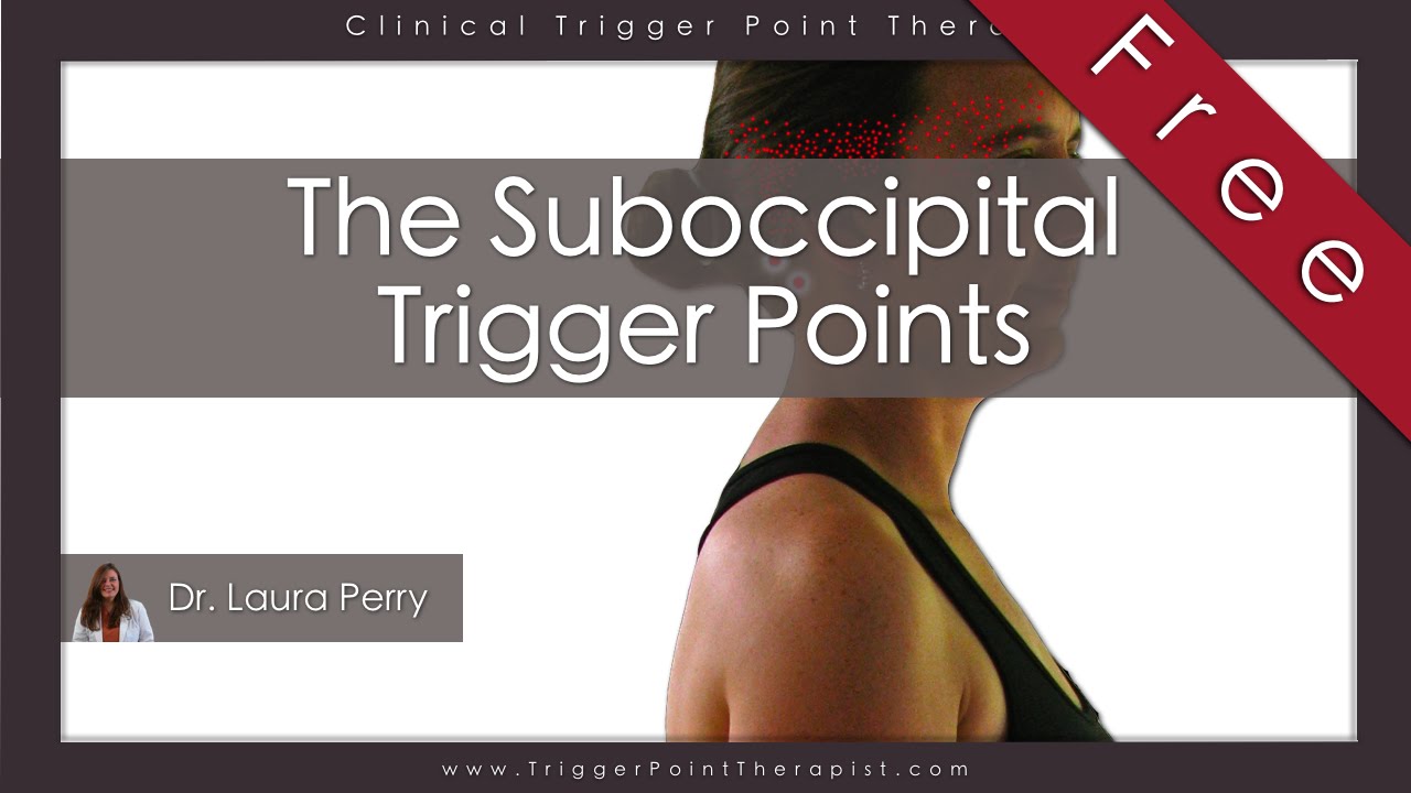 The Suboccipital Trigger Points (Free Full Video)