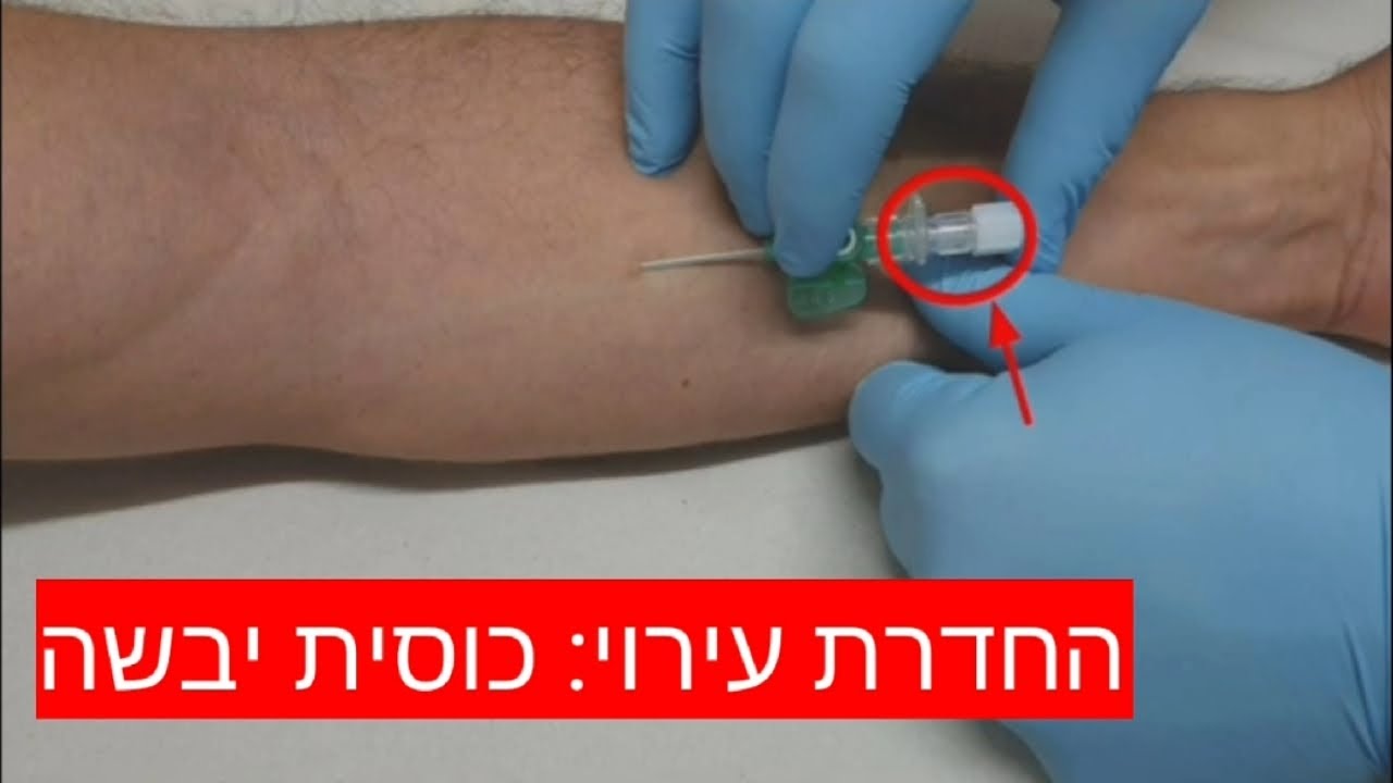 החדרת עירוי: לעולם (לא) בעקבות השמש
