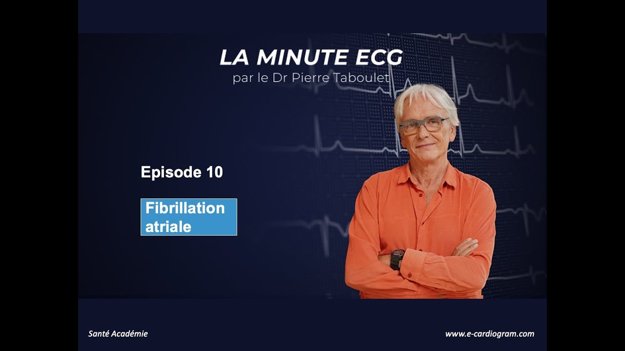 ECG minute 10. Fibrillation atriale
