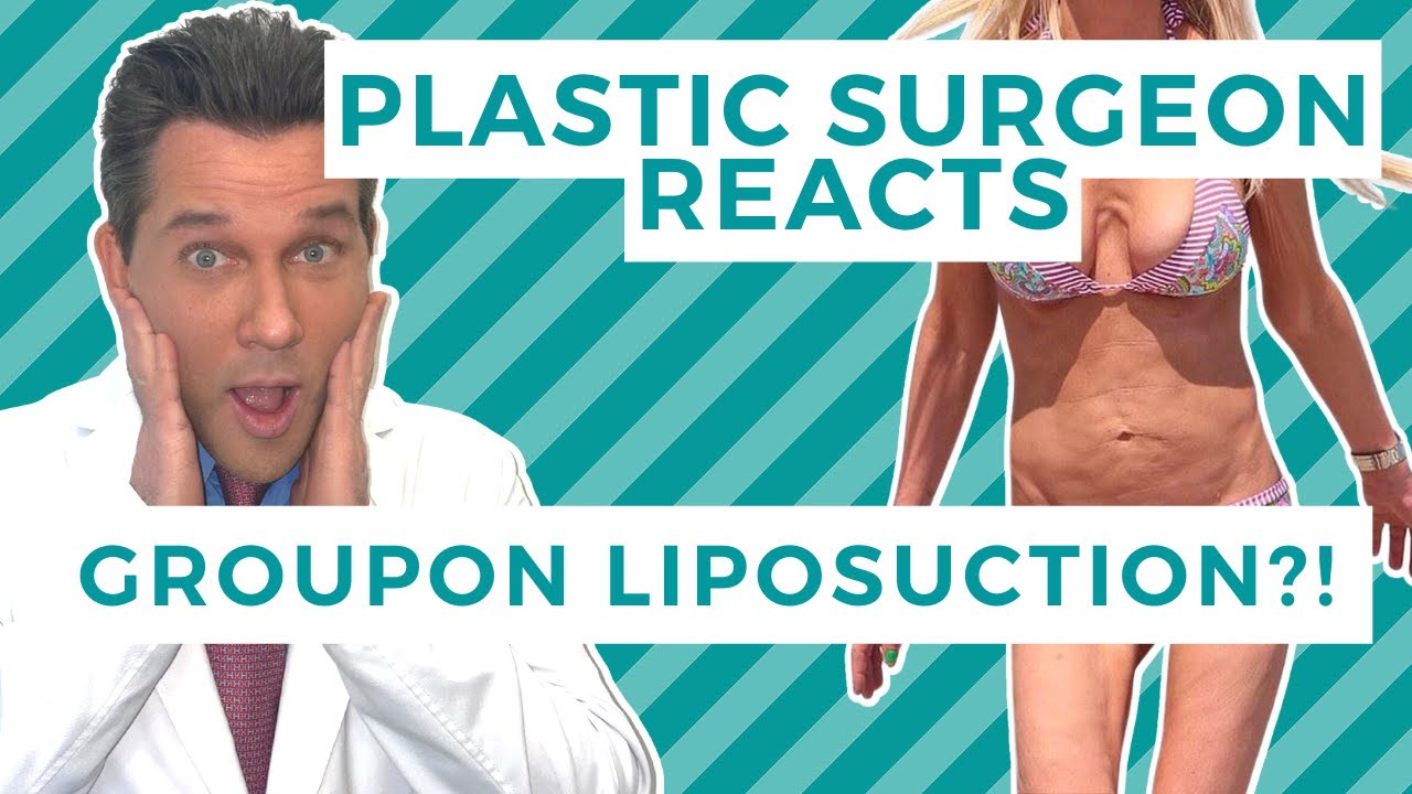 Botched by Groupon: Liposuction performed by Naturopaths - Surgeon Reacts