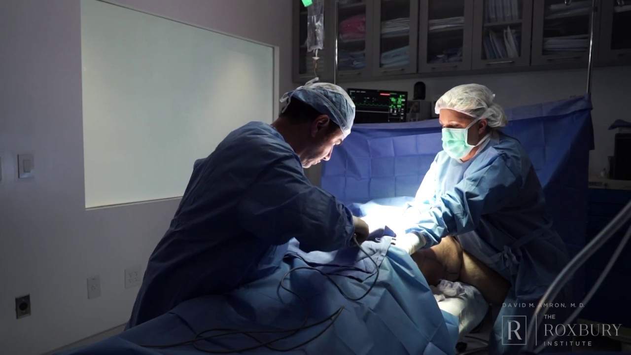 Rare Male Lipedema Case at The Roxbury Institute: Part 2