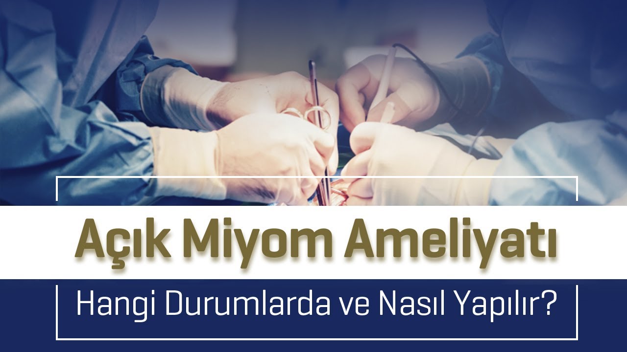 Açık Miyom Ameliyatı Nasıl Yapılır? Açık Miyom Ameliyatı Riskleri Nelerdir? - Doç. Dr. Aydın Köşüş