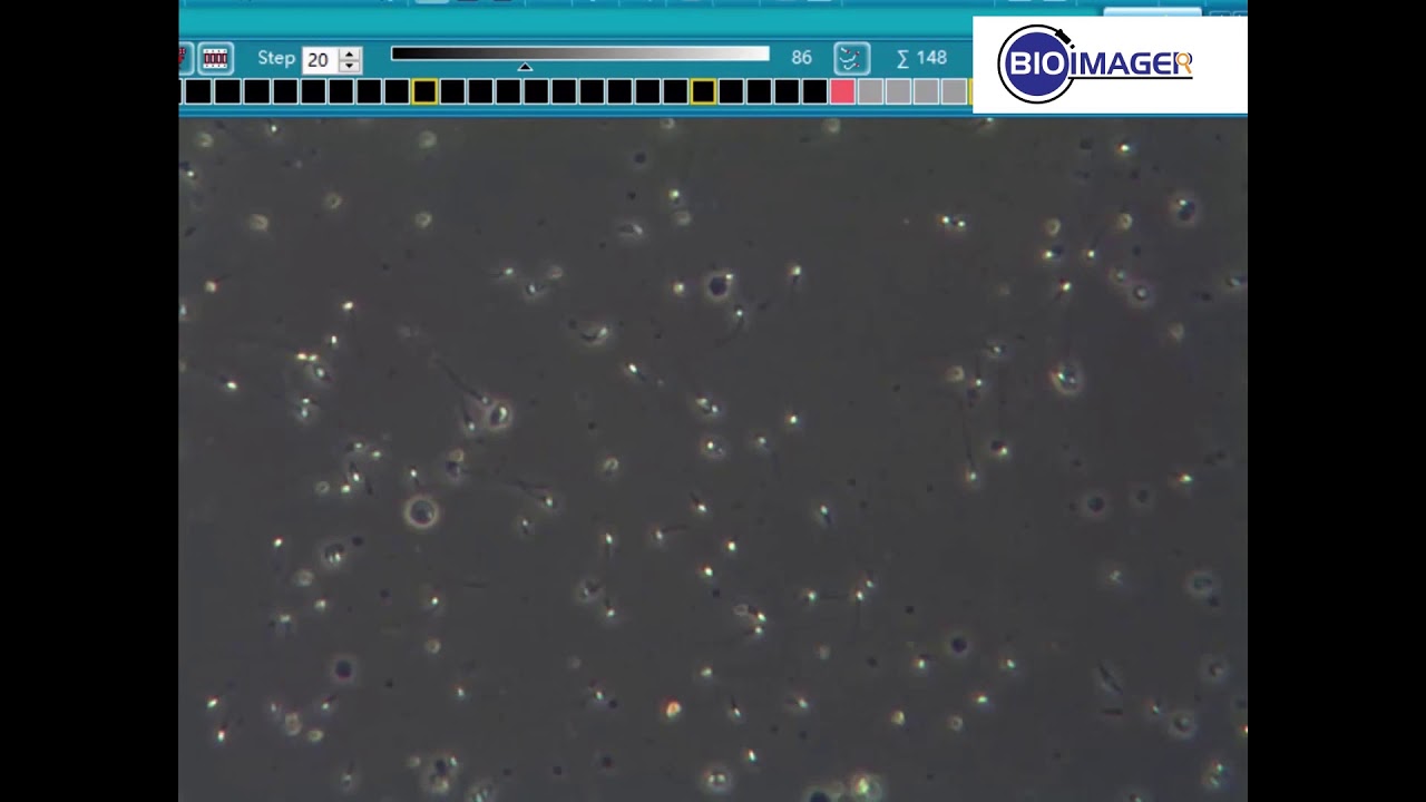 BUM400A Fully Motorized Auto-Focus Biological Microscope- Sperm Analysis Part 2 of 2