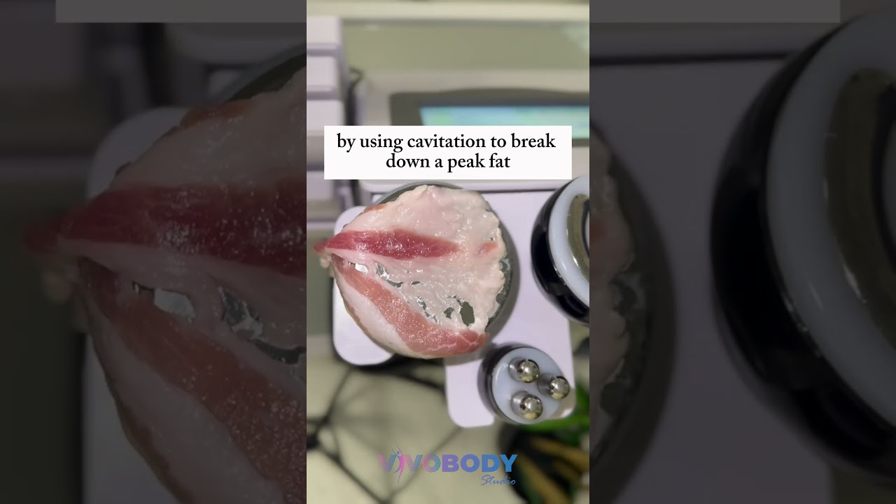 How Does Cavitation Treatment Destroy Stubborn Fat? 