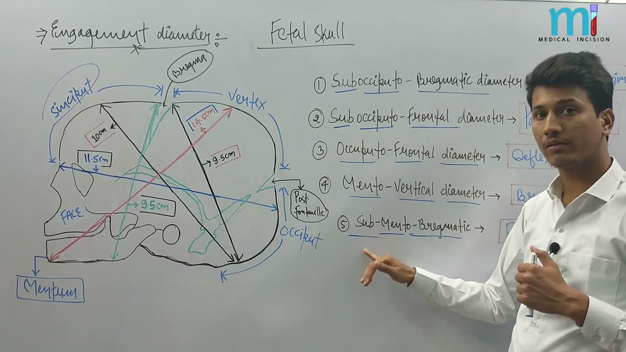 Fetal Skull | Foetal Skull In Hindi | Maternity Nursing | Pediatrics | Bsc Nursing | Paramedical|