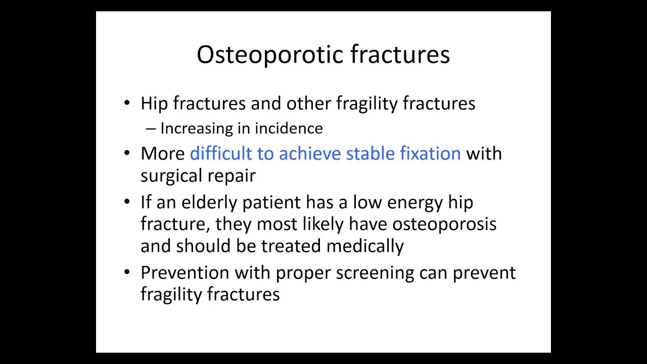 Orthopaedic trauma for med students 5