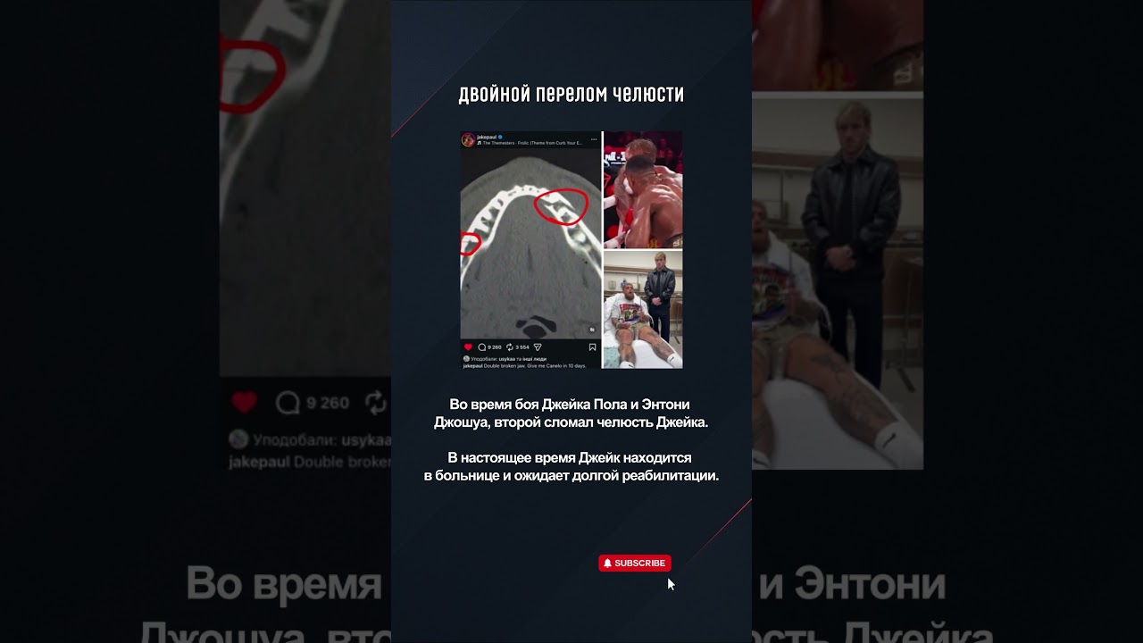 Jake Paul в больнице! 