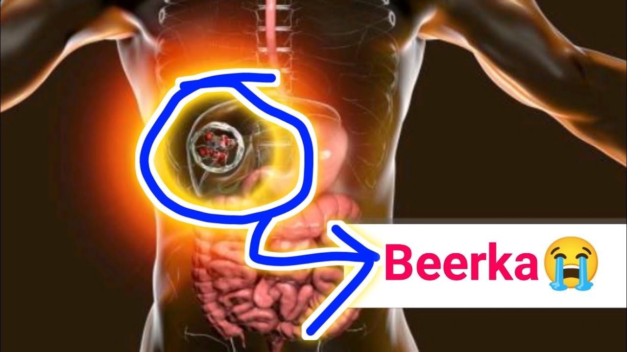 Sababaha keena in Beerka Bararo oo Dhaawac halis ah gaaro....