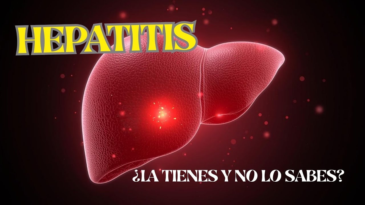 ¿Tienes Hepatitis y No lo Sabes? Síntomas, Diagnóstico y Prevención