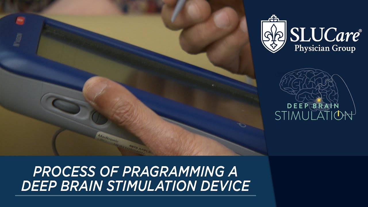 What Happens in Programming Patients for Deep Brain Stimulation?