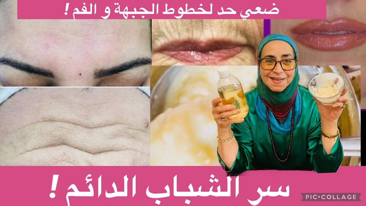 أنا مسؤولة عن كلامي: امسحي نهائيًا تجاعيد الفم وخطوط الجبهة بماسك طبيعي معجزة لن تصدقي النتجية
