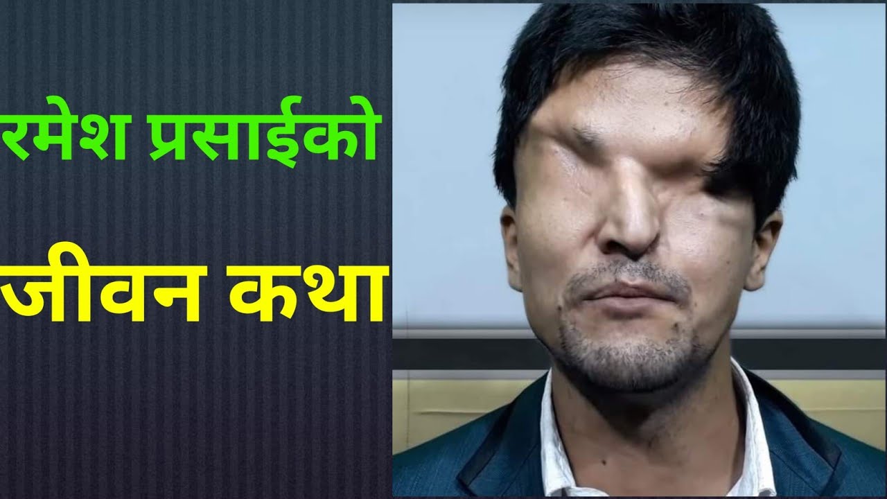 रमेश प्रसाई को जीवन कथा ।। Ramesh Prasai Ko Jiwan Katha || Biography Of Ramesh Prasai