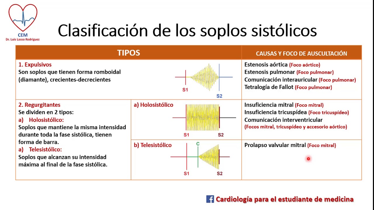 Soplos Cardíacos