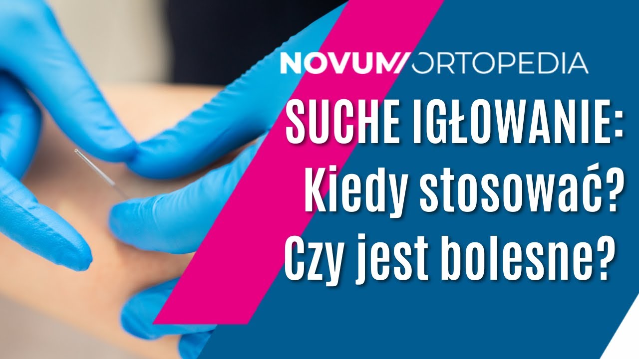 SUCHE IGŁOWANIE - na czym polega ta metoda? | Novum Ortopedia