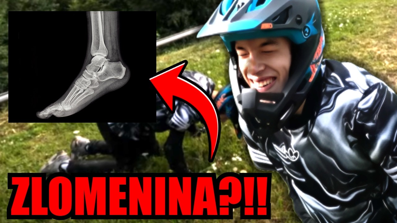 NEJVĚTŠÍ CRASH MÉ KARIÉRY NA KOLE?!😵🚴‍♂️