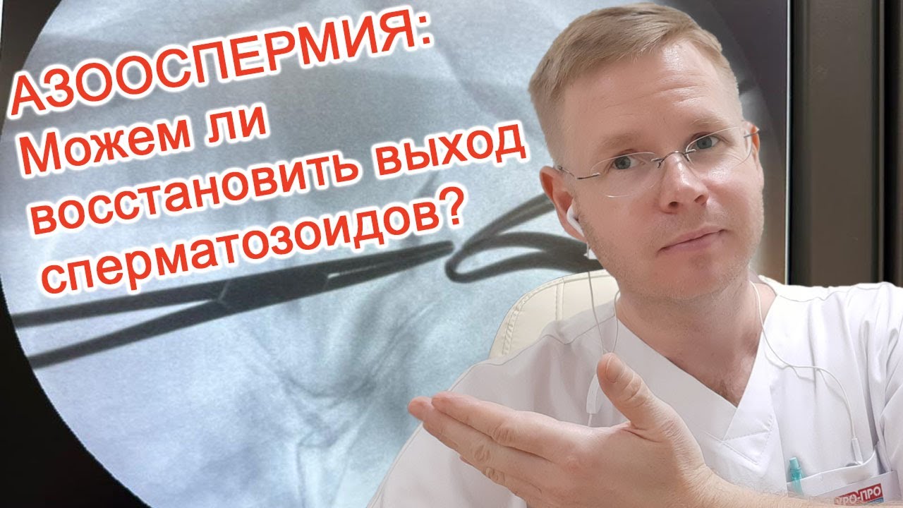 АЗООСПЕРМИЯ: можем ли восстановить выход сперматозоидов? // Доктор Черепанов