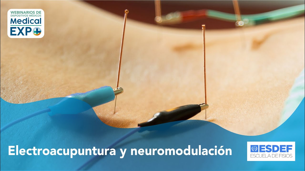 Electroacupuntura y neuromodulación