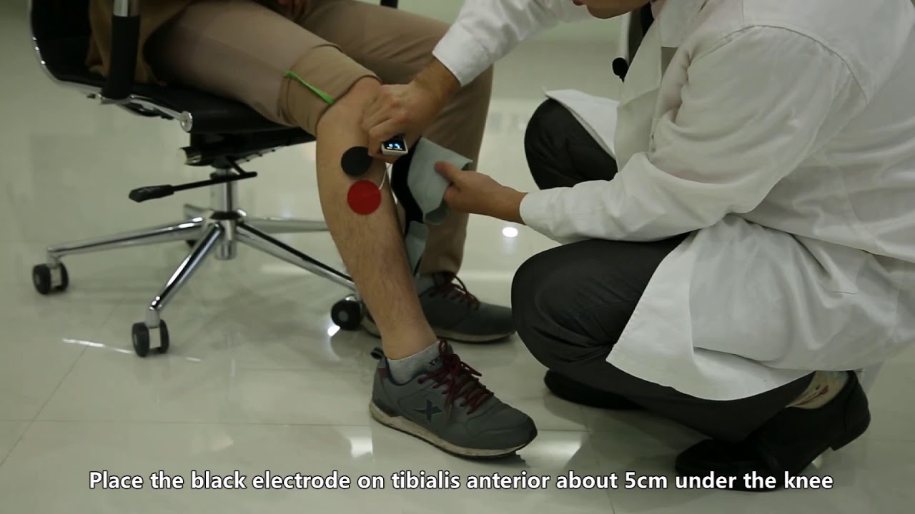 Where to place the electrode-- XFT foot drop system