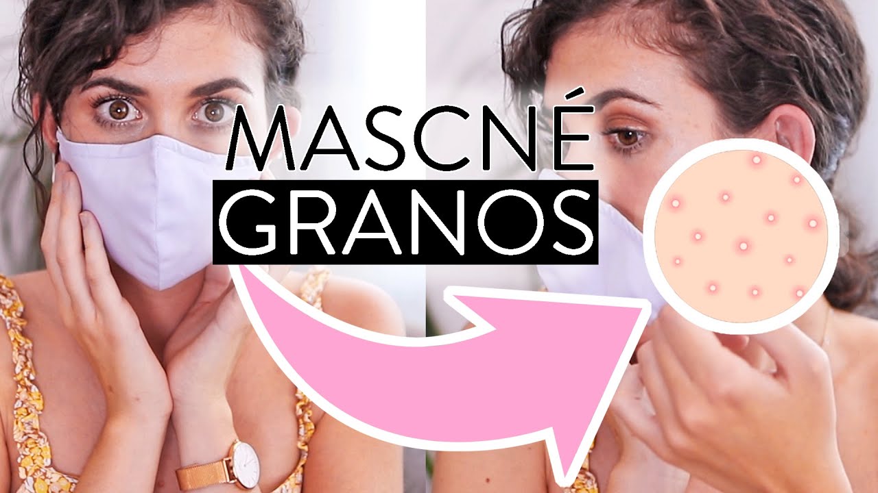 MASCNE 😷 : ACNÉ por uso de MASCARILLA!