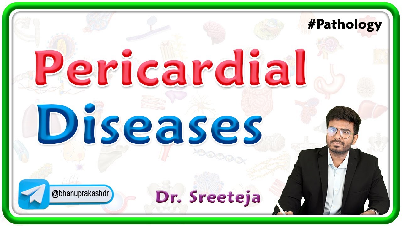 1: Pericardial Diseases | Pathology USMLE Step 1
