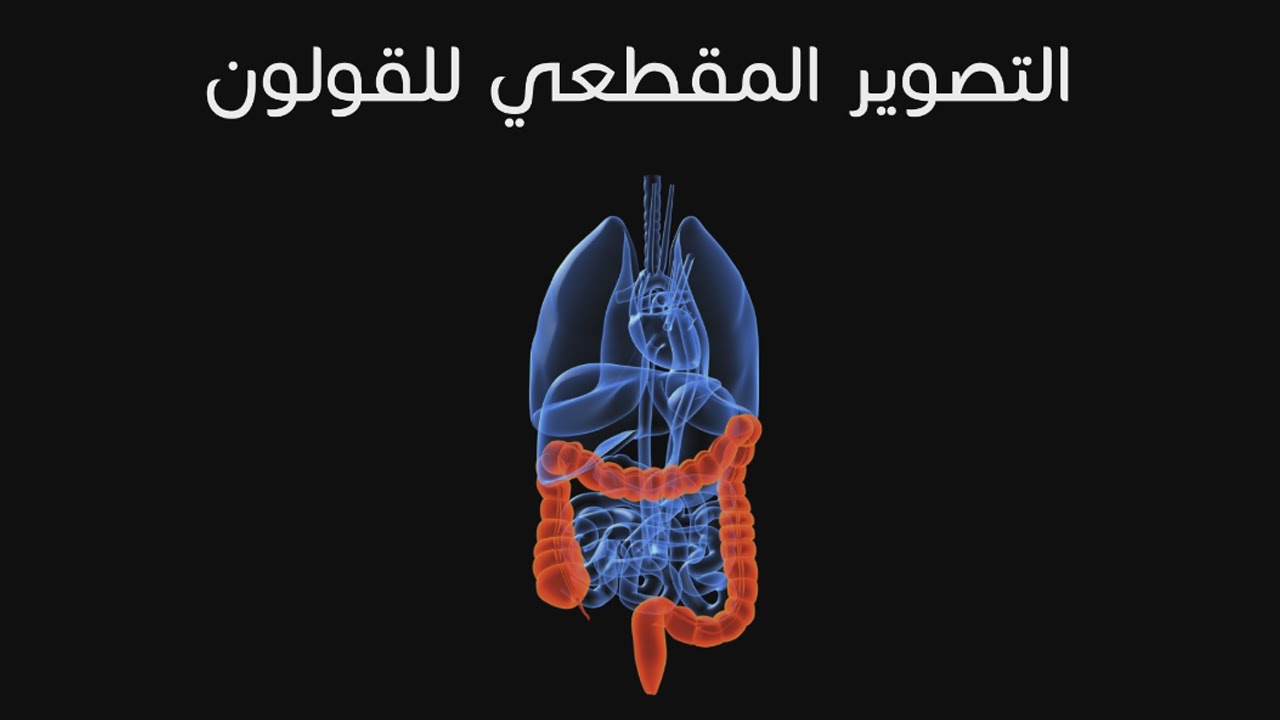 التصوير المقطعي للقولون