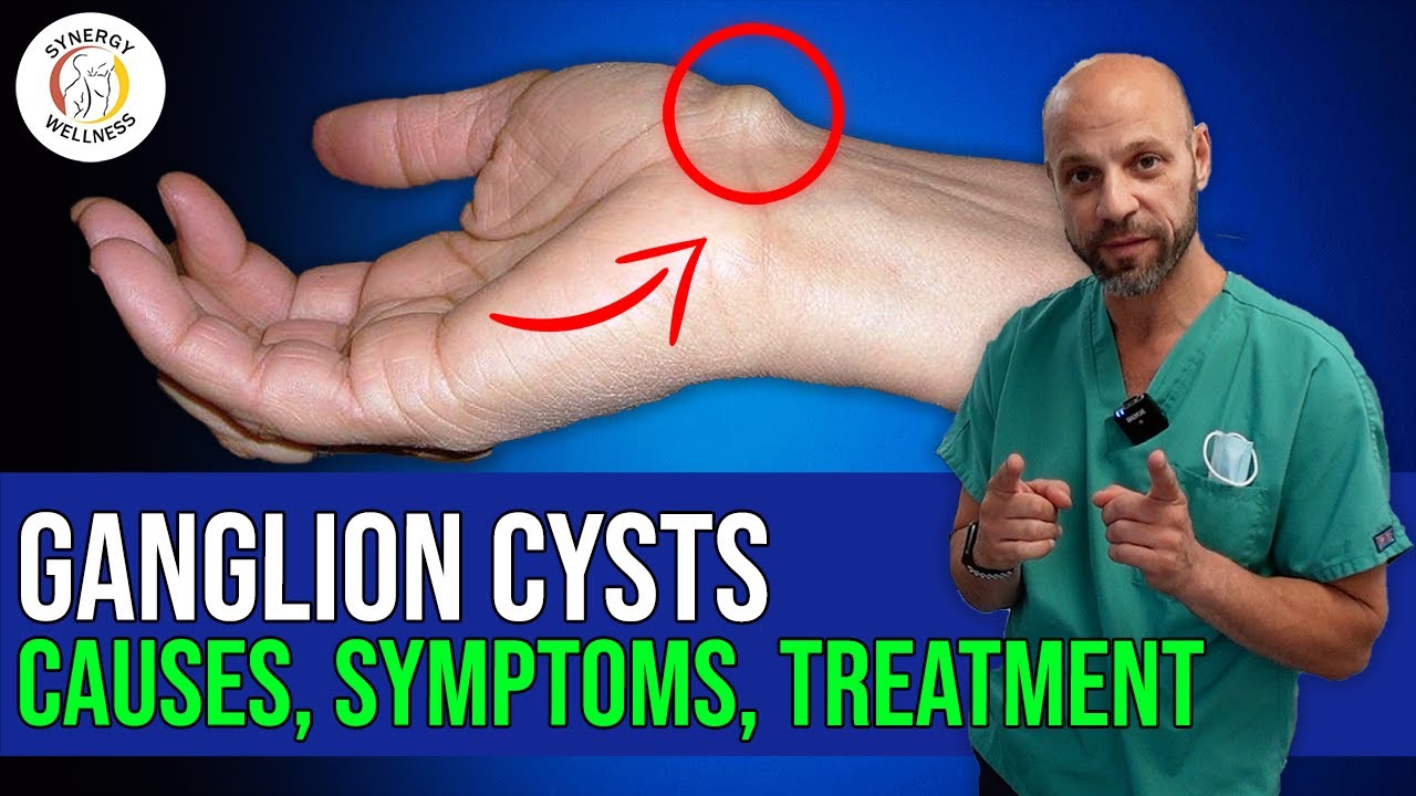Ganglion Cysts | Causes | Symptoms | Treatments