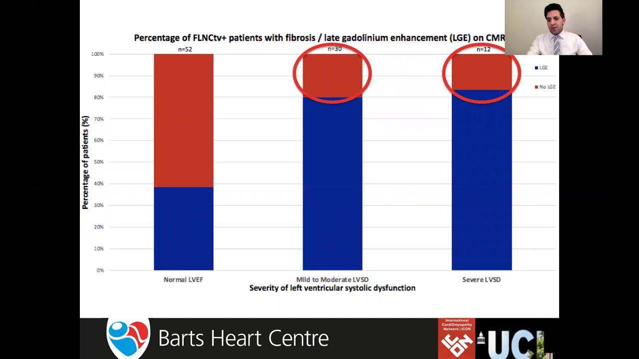 Natural history of dilated cardiomyopathy caused by FLNC truncating variants-ICON Heart Muscle Talks
