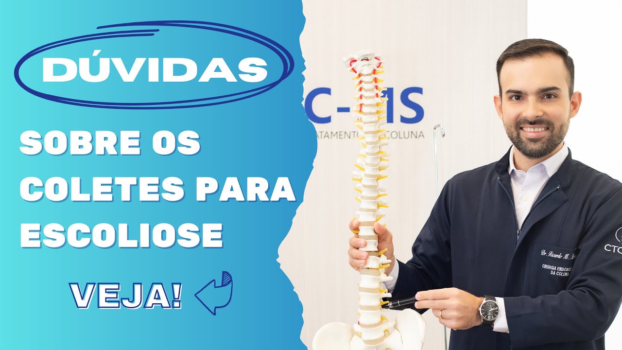 3 Dúvidas dos meus PACIENTES sobre os Coletes para Escoliose