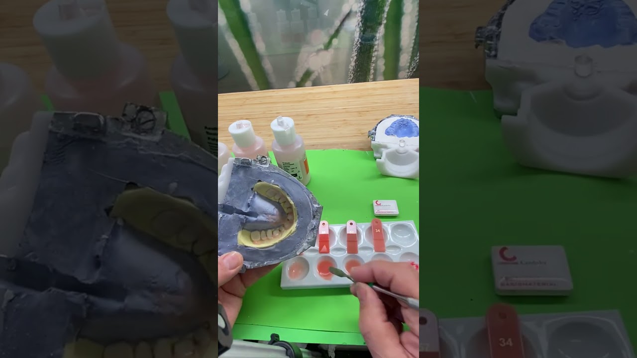 Tinting Your Denture Base