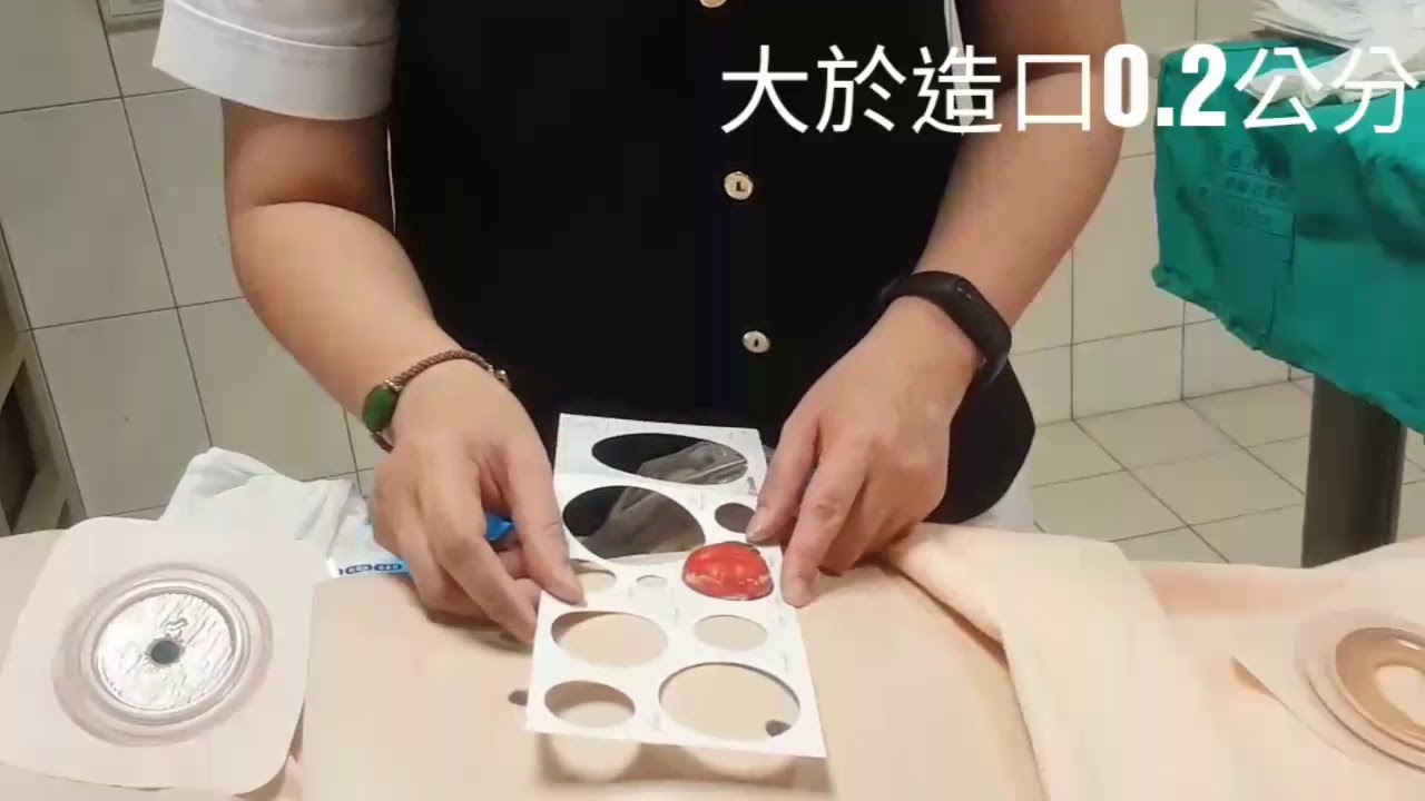 腸造口更換